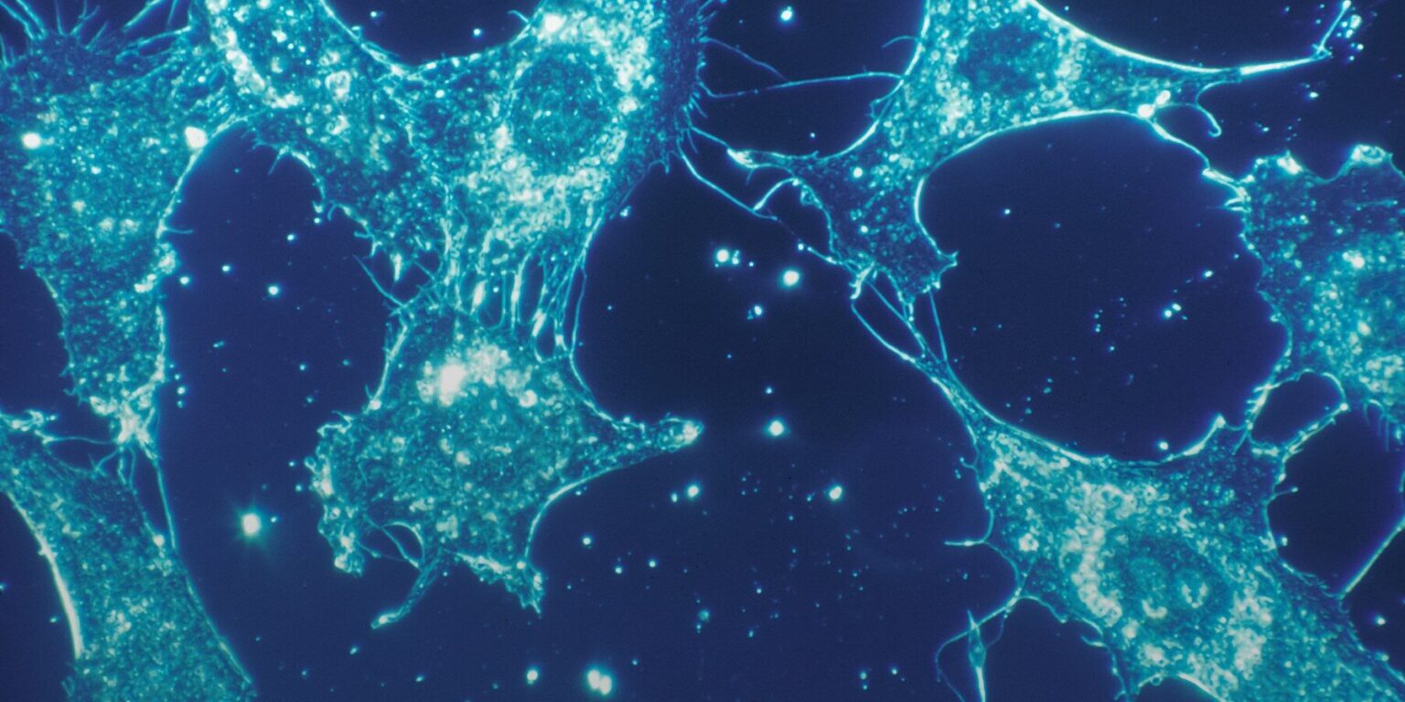 a close up of a cell phone with a blue background